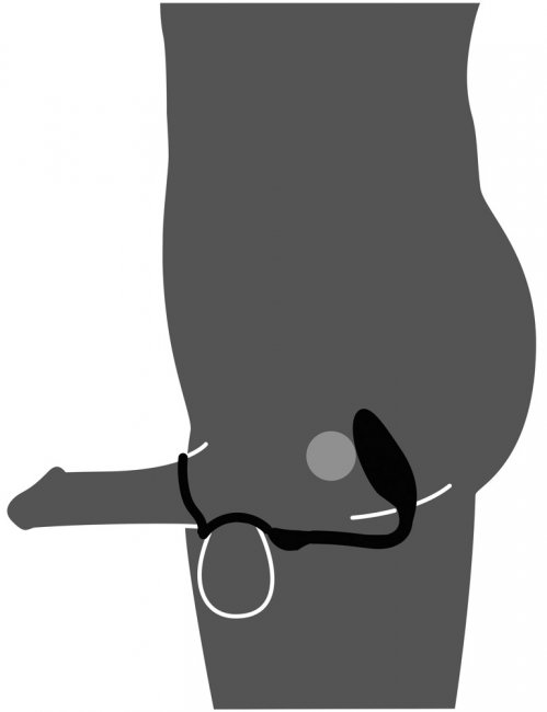 Cock And Ball Ring With A RC Butt Plug